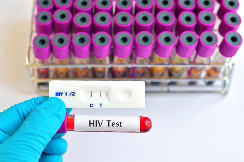 为什么说感染性病可增加感染艾滋病病毒的风险